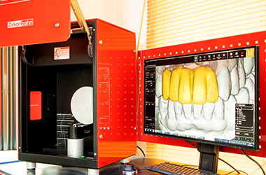 歯科技工物製作の未来　「デジタル技工」